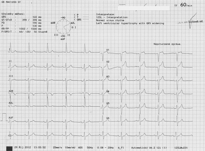 EKG z praxe 24 Medicína nemoci studium na 1 LF UK